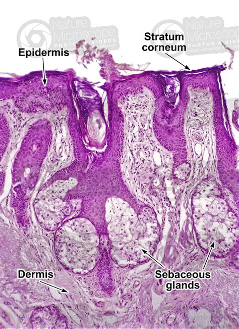 Sebaceous Glands Histology