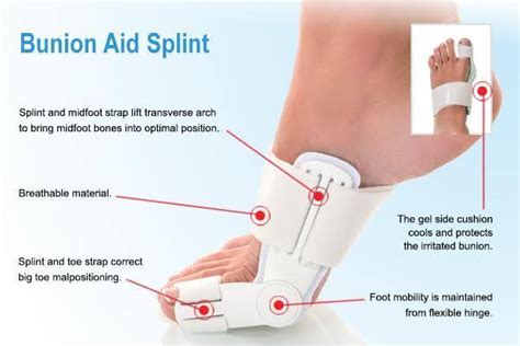 bunion splint - BLUEPRINT NIC ORTHOMEDICALS