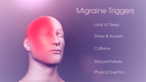 Migraine - Symptoms, Causes, & Treatment - Scientific Animations