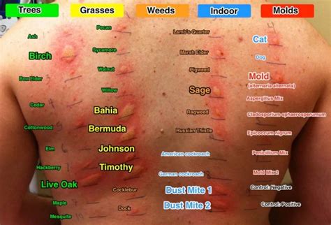 carpet beetle bites allergic reaction | www.resnooze.com