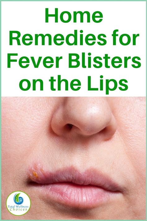 How To Cover Fever Blisters With Makeup