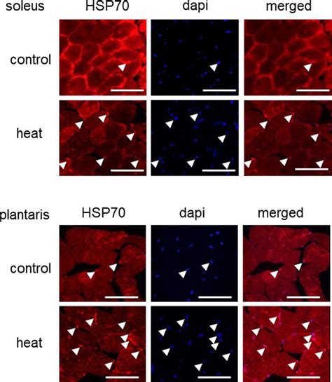 Frontiers | Nuclear Accumulation of HSP70 in Mouse Skeletal Muscles in ...