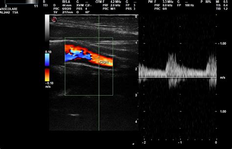 Vascular Ultrasound — Bolton Medical Imaging