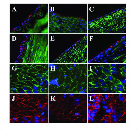 | Expression of endothelial biomarkers in neo-endothelial cells of ...