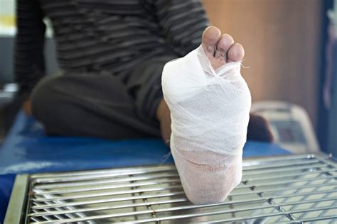 How Diabetic Foot Ulcers Lead to Amputations - Podimetrics