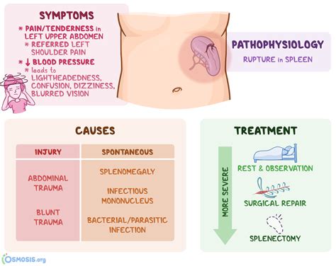 Ruptured Spleen: What Is It, Causes, Symptoms | Osmosis