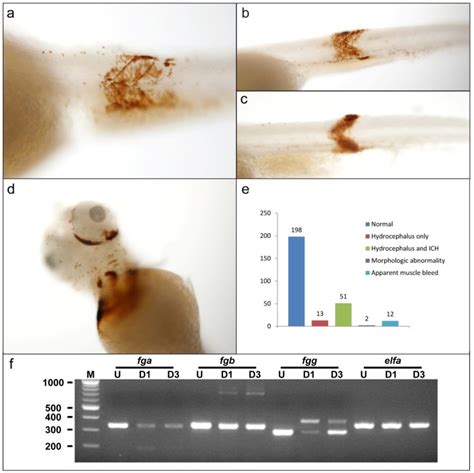 Other sites of hemorrhage were visible in morpholino-injected larvae ...