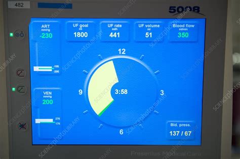 Haemodialysis machine - Stock Image - C015/5972 - Science Photo Library