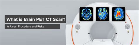 Brain PET CT Scan | Its Uses, Procedure and Risks