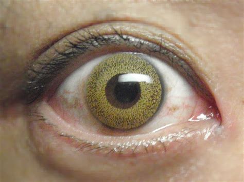 File:Color contact lens eye brown.jpg - Wikimedia Commons