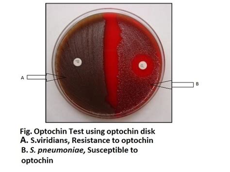 Optochin Susceptibility Test for Streptococcus pneumoniae