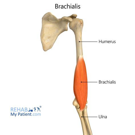 Brachialis Tendon Tear