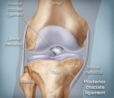 Posterior Cruciate Ligament (PCL) Injury - Sports Medicine