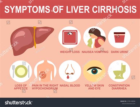 Liver Cirrhosis Symptom Useful Advices Infographic: vector de stock ...