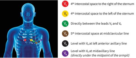 12 Lead Ecg Limb Electrode Placement