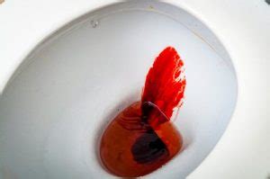 What Does Blood in Stool Look Like? Home Remedies for Rectal Bleeding