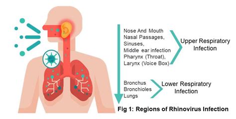 Rhinovirus Infection - Symptoms | Treatment | Prevention