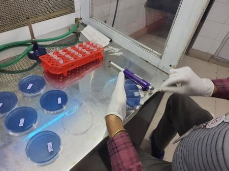 Sample loading on incubation plates | Download Scientific Diagram