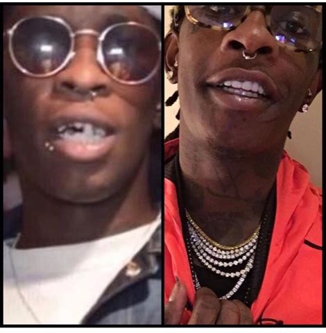 Rappers Teeth Before And After