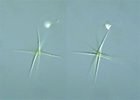 Protist Images: Ankistrodesmus falcatus