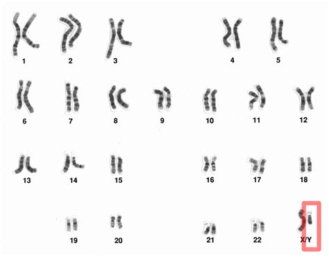 Y chromosome - Wikipedia