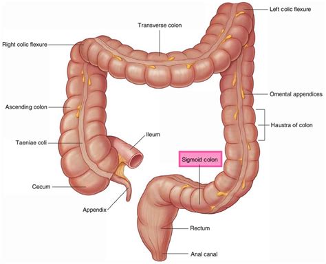 Sigmoid colon anatomy, location, function, polyps, diverticulosis & cancer