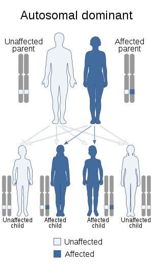 TIL of the MOMO syndrome. It's a very rare genetic disorder ...