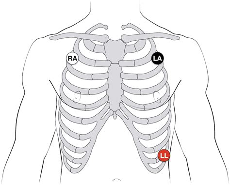 [DIAGRAM] Telemetry 3 Lead Diagram - MYDIAGRAM.ONLINE