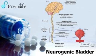 Neurogenic-Bladder