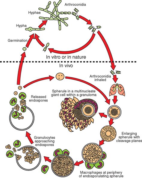 Coccidioidomycosis | Veterian Key