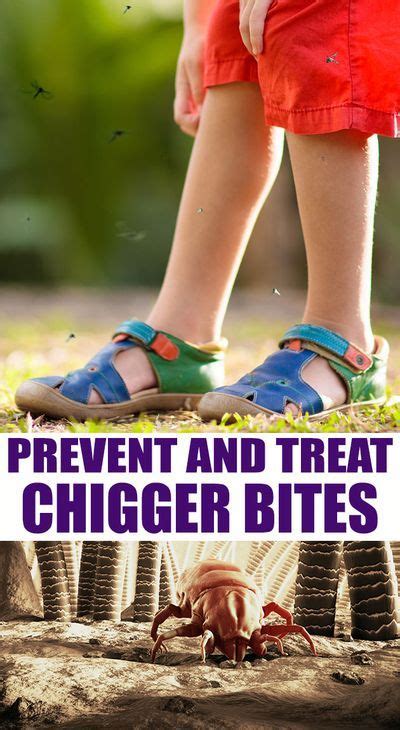 You will find almost 50 different ways to prevent and treat chigger ...