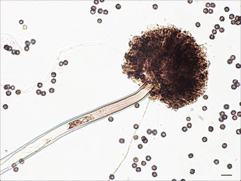 Aspergillus niger | Institut national de santé publique du Québec