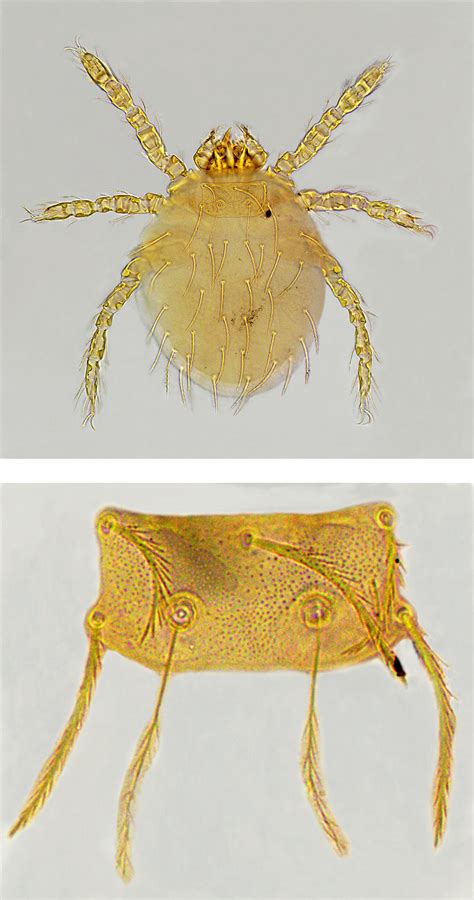 Infestation of chigger mites on Chinese mole shrew, Anourosorex ...