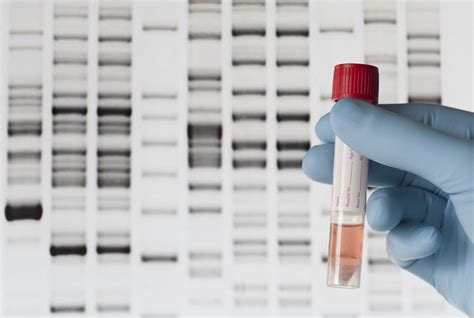 DNA Testing Firms Promise Not to Share Data Without User Consent