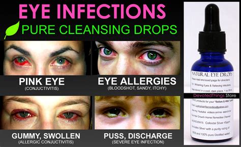 Natural Eye Drops for Pink Eye and Eye Infections Pure Cleansing Drops