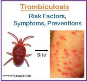 Trombiculosis (Chigger Infestation) - We Care