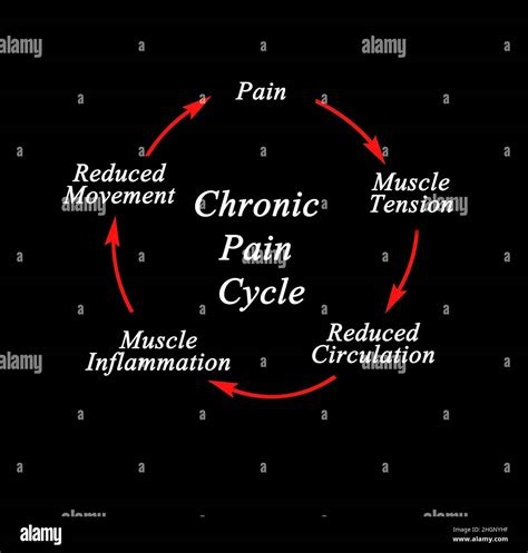 Steps in Chronic Pain Cycle Stock Photo - Alamy