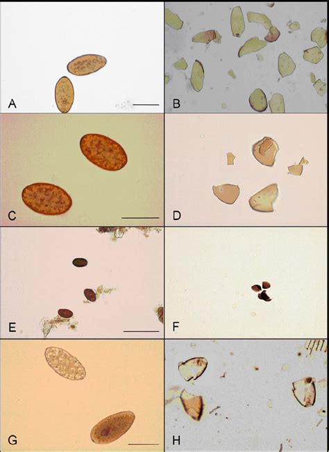 Eggs of Fasciola hepatica (A, B), Fascioloides magna (C, D ...