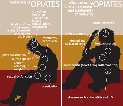 Health Effects of Opiate Addiction - Opiate.com