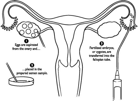 Female Reproductive System Drawing at GetDrawings | Free download