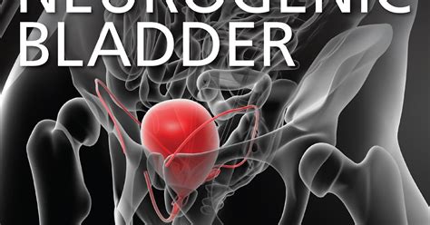 Textbook of the Neurogenic Bladder 3rd Edition - Medical Book For Free ...