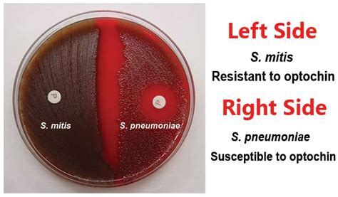 Optochin Susceptibility Test for the identification of Streptococcus ...