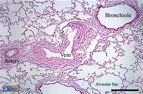 lungs histology - Google 検索 | Biology labs, Histology slides, Medical ...