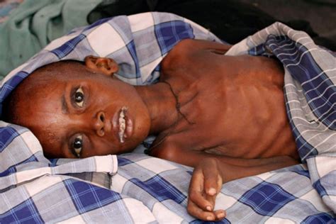 Helping famine victims in Somalia