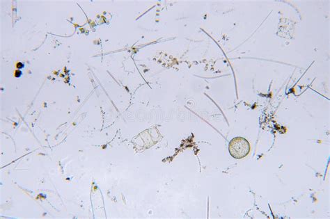 Marine Aquatic Plankton Under Microscope View Stock Image - Image of ...