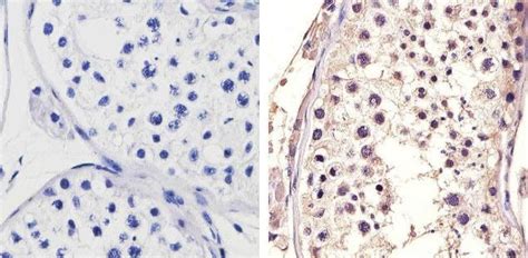 HSP70 Antibody (33-3800)