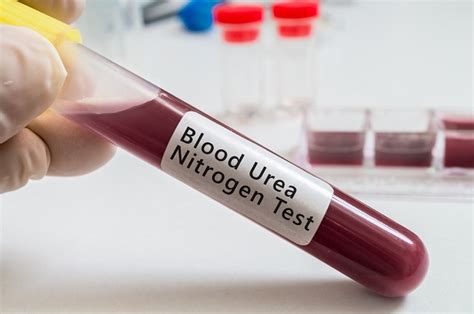 Blood Urea Nitrogen (BUN) Test and Ranges | Biology Dictionary