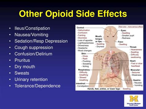 PPT - What’s New I n Acute Pain Management: Reducing Our Dependence O n ...