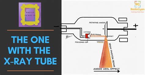 The One with The X-Ray Tube - Physics with F.R.I.E.N.D.S - RadioGyan