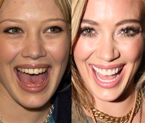 They May Be Beautiful But These Celebs Were Given A Bad Set Of Chompers